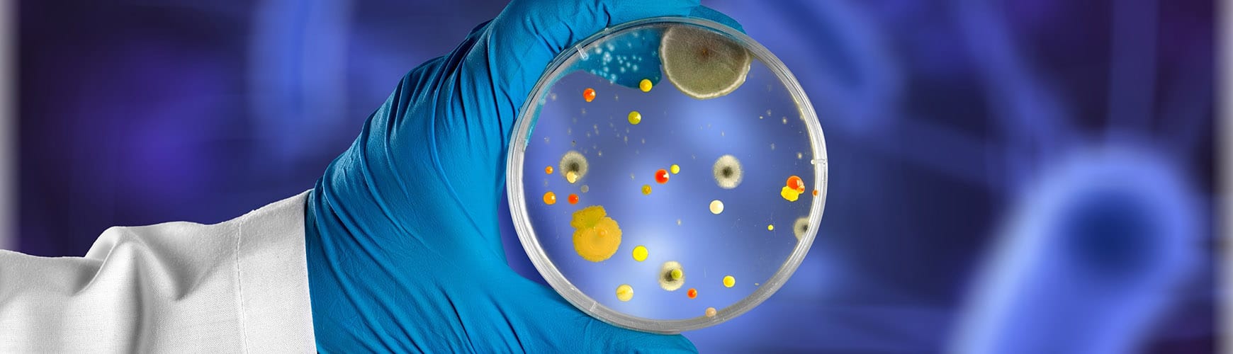 We have compiled a mini-encyclopedia of the most common types of mould found in buildings. Read more here