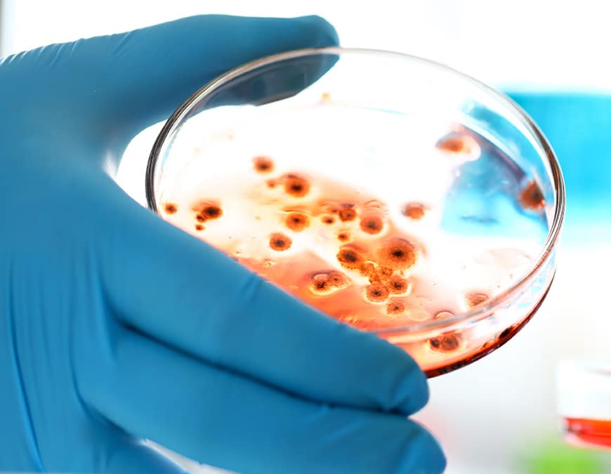 AGX Nordic’s aim is to solve problems with mould, moisture and radon all over Europe