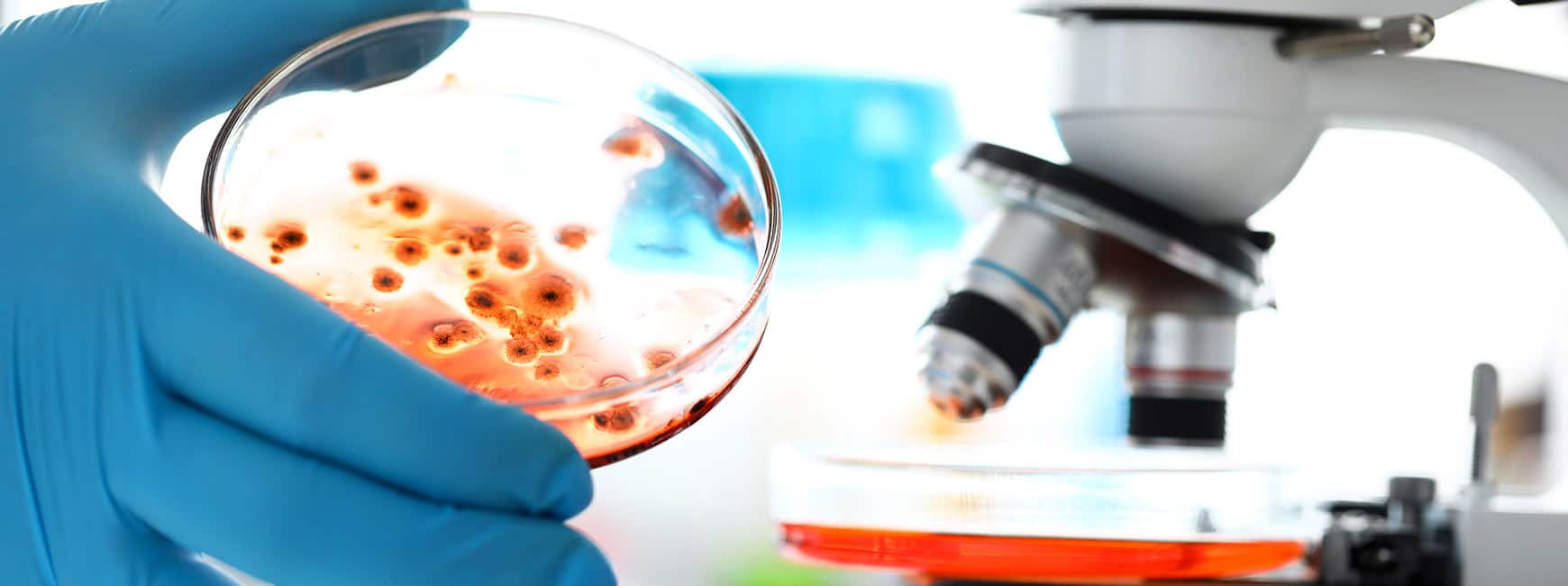 Mould will leave spores and other microscopic particles in the indoor air we breathe and this can lead to health issues in humans!